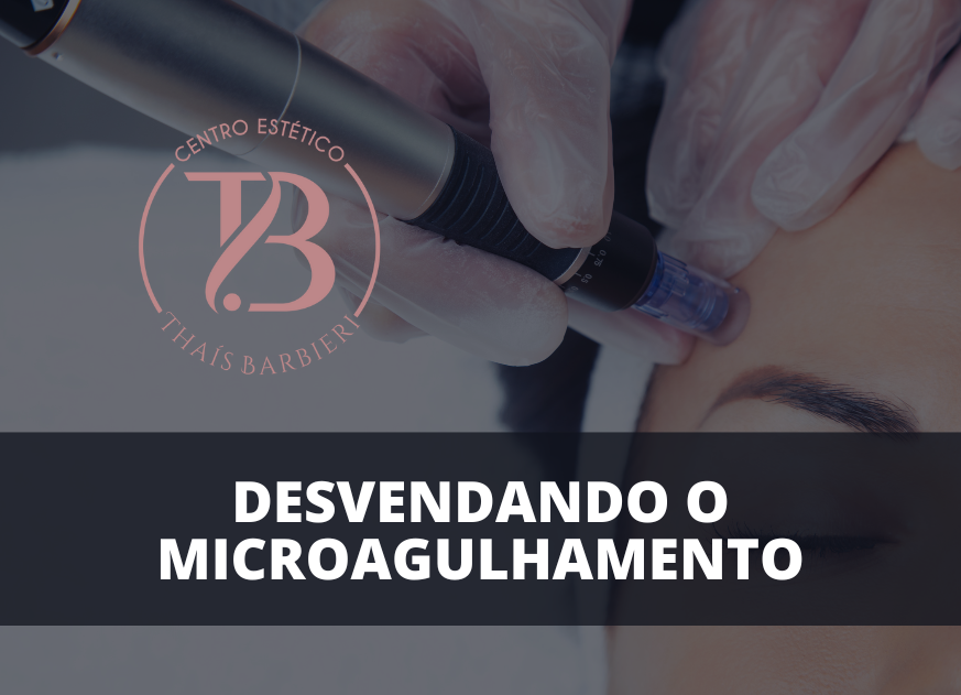 Desvendando o Microagulhamento