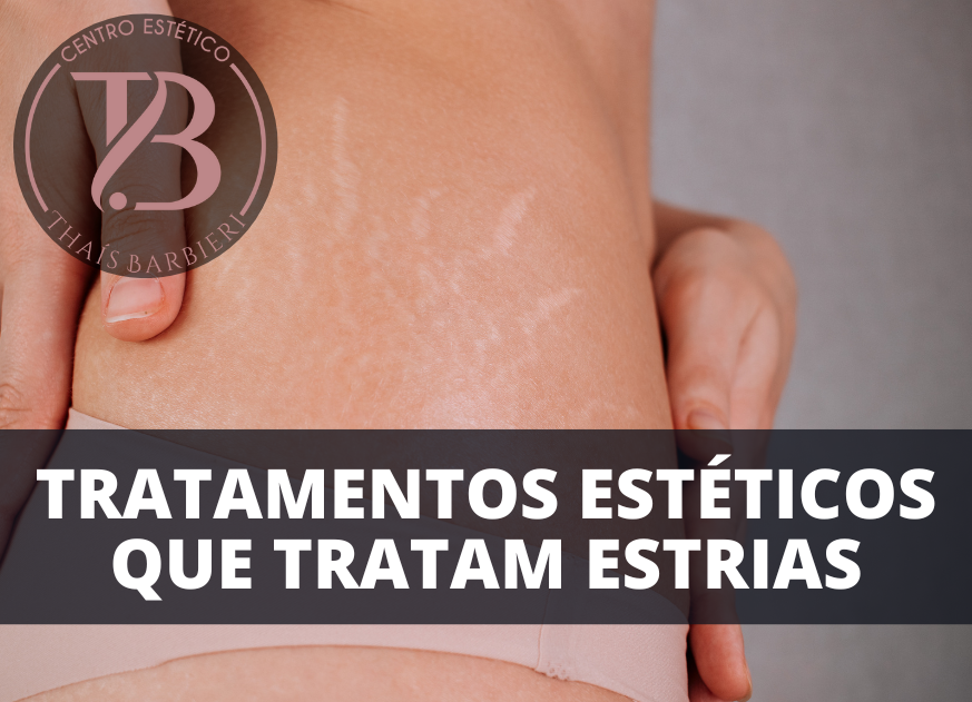 Estrias Tratamentos estéticos que tratam